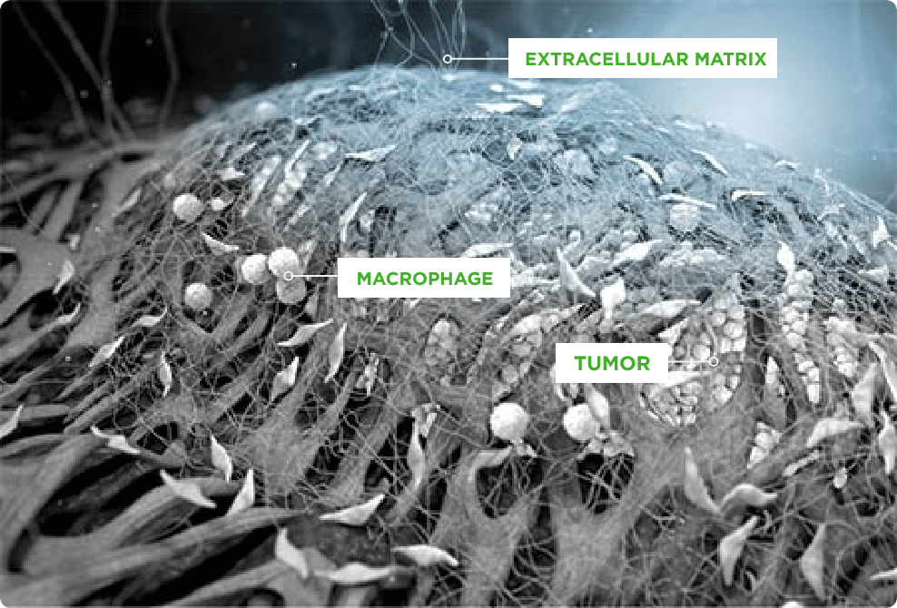 Dense stroma surrounds pancreatic tumors