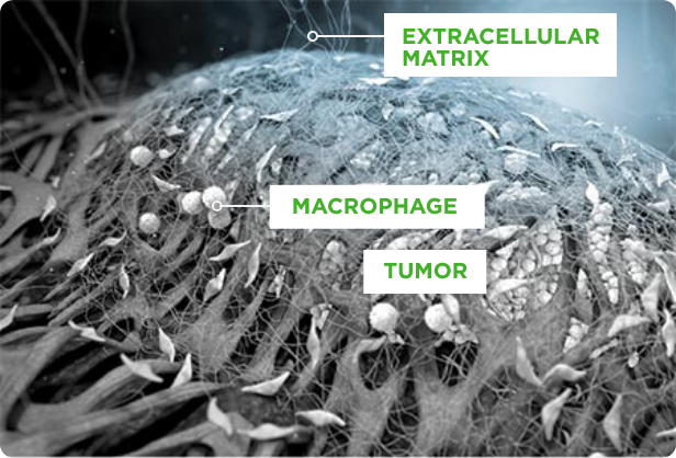 Dense stroma surrounds pancreatic tumors